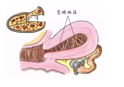 做试管费用价格